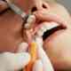dinti ficsi de la Dental Privilege