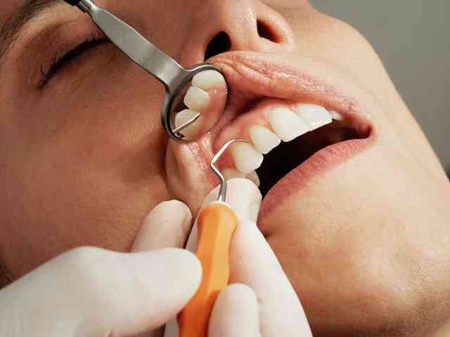 dinti ficsi de la Dental Privilege