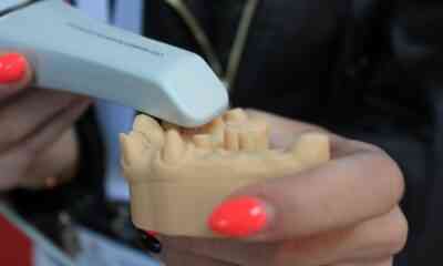 implant dentar cu dinti ficsi