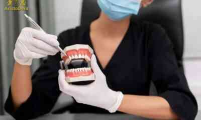 Implanturile dentare