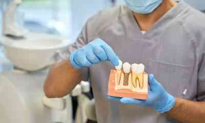 implant dentar Bucuresti