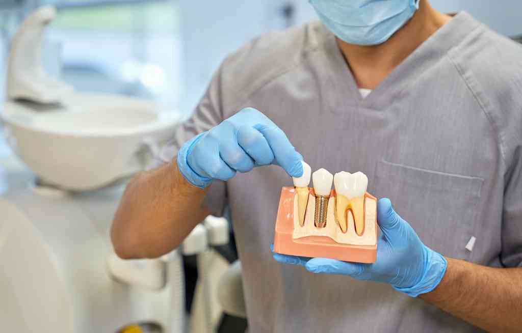implant dentar Bucuresti