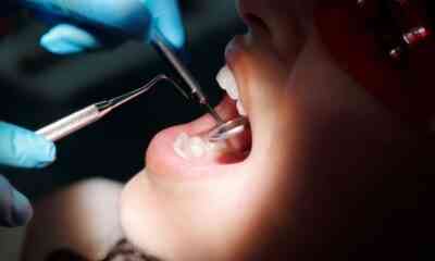 dinti ficsi de la Dental Privilege