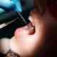 dinti ficsi de la Dental Privilege