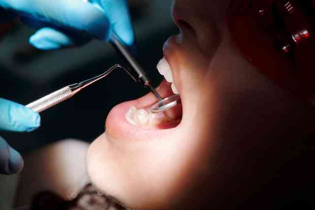 dinti ficsi de la Dental Privilege
