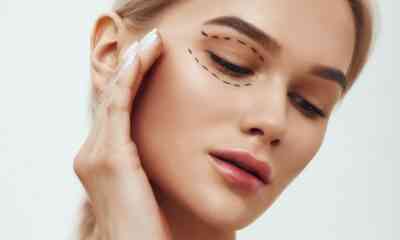 blefaroplastie nonchirurgicala
